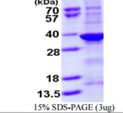 Recombinant Human Sulfatase Modifying Factor 1/SUMF1 Protein [NBP1-72540]