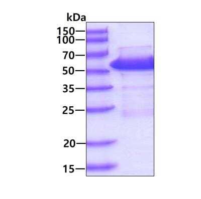 SDS-PAGE Recombinant Human Suppressor of Fused His Protein