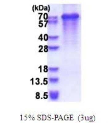 SDS-Page: Recombinant Human Synaptotagmin Protein [NBP2-51650] - 15% SDS Page (3 ug)