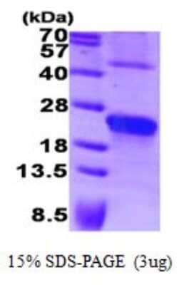 SDS-Page: Recombinant Human Syndecan-4 Protein [NBP1-72277] - 15% SDS-PAGE (3ug)