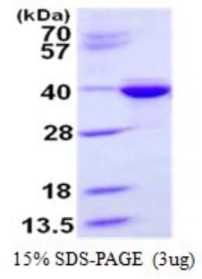 SDS-Page: Recombinant Human Syntaxin 3 Protein [NBP1-99023] - 15% SDS-PAGE (3ug)