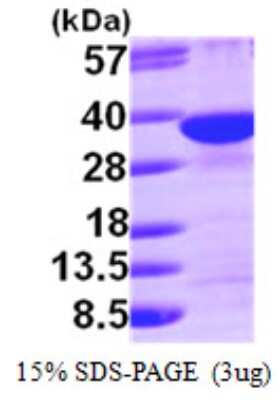 SDS-Page: Recombinant Human Syntenin 1 Protein [NBP1-50893] - 15 % SDS-PAGE (3ug)
