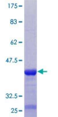 SDS-PAGE Recombinant Human TARSH GST (N-Term) Protein