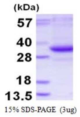 SDS-Page: Recombinant Human TATDN3 Protein [NBP1-98989] - 15% SDS-PAGE (3ug)