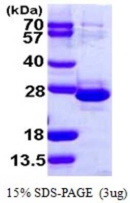 SDS-Page: Recombinant Human TCEAL1 Protein [NBP1-72316] - 15% SDS-PAGE (3ug)