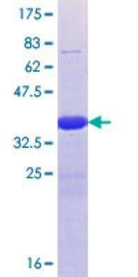 SDS-PAGE Recombinant Human TET1 GST (N-Term) Protein