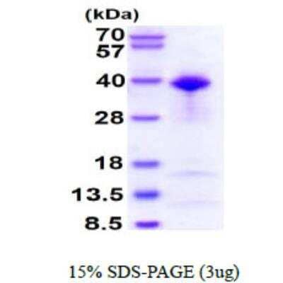 SDS-PAGE Recombinant Human TFIIB His Protein