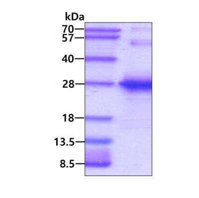 SDS-PAGE Recombinant Human TGIF2LY His Protein