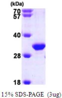 SDS-PAGE Recombinant Human TIP30 His Protein