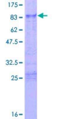 SDS-Page: Recombinant Human TIS11D Protein [H00000678-P01] - 12.5% SDS-PAGE Stained with Coomassie Blue.