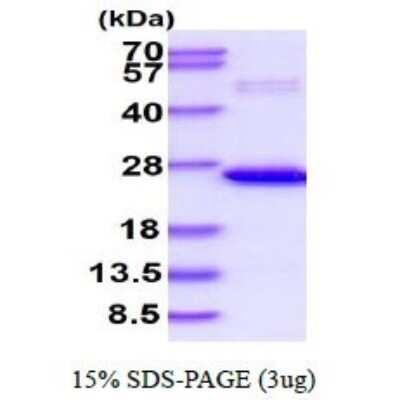 SDS-Page: Recombinant Human TL1A/TNFSF15 His Protein [NBP1-72297] - 15% SDS-PAGE (3ug)