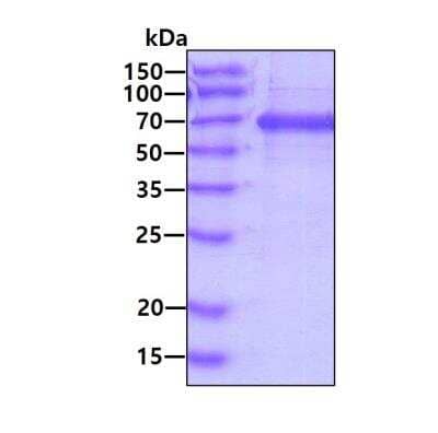 Recombinant Human TLR2 Protein [NBP2-52368] - 3ug by SDS-PAGE under reducing condition and visualized by coomassie blue stain