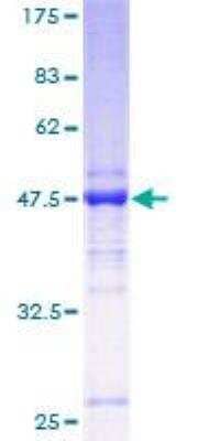 SDS-Page: Recombinant Human TMED2 Protein [H00010959-P01] - 12.5% SDS-PAGE Stained with Coomassie Blue.