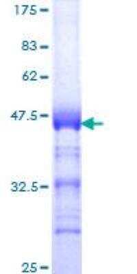 SDS-Page: Recombinant Human TOP2B Protein [H00007155-Q01] - 12.5% SDS-PAGE Stained with Coomassie Blue.