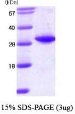 SDS-Page: Recombinant Human TPMT Protein [NBC1-18525] -  TPMT, 28 kDa (245 aa), confirmed by MALDI-TOF with a purity of 95% by SDS - PAGE
