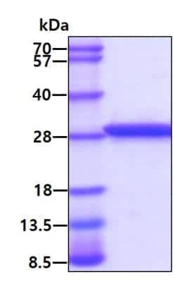 SDS-PAGE Recombinant Human TPT1/TCTP His Protein