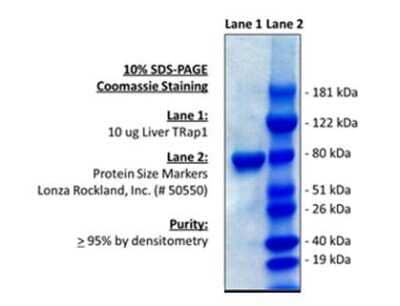 SDS-Page: Recombinant Human TRAP1 Protein [NBP1-99222]