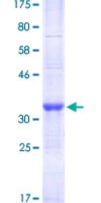 SDS-Page: Recombinant Human TRIM49 Protein [H00057093-Q01] - 12.5% SDS-PAGE Stained with Coomassie Blue.