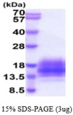 SDS-Page: Recombinant Human TSPAN7/TM4SF2 Protein [NBP2-59575] - 15% SDS-PAGE (3ug)