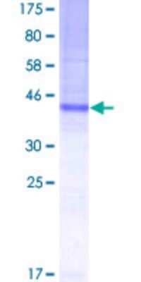 SDS-Page: Recombinant Human TSPAN8/TM4SF3 Protein [H00007103-P01] - 12.5% SDS-PAGE Stained with Coomassie Blue.