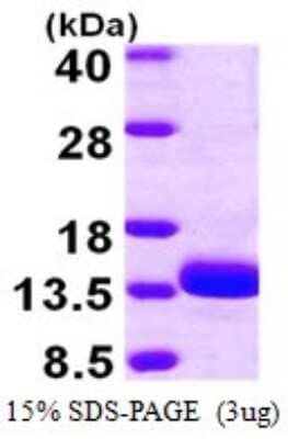 SDS-Page: Recombinant Human TSTD1 Protein [NBP1-78798] - 15% SDS-PAGE (3ug)