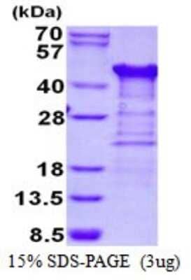 SDS-Page: Recombinant Human TTC1 Protein [NBP1-98891] - 15% SDS-PAGE (3ug)