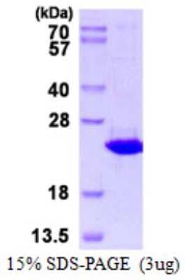 SDS-Page: Recombinant Human TXNDC12 Protein [NBP1-98938] - 15% SDS-PAGE (3ug)