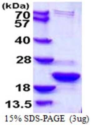 SDS-Page: Recombinant Human TXNL4B Protein [NBP1-72336] - 15% SDS-PAGE (3ug)