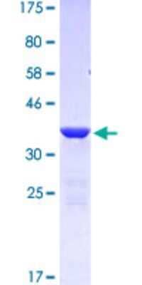 SDS-Page: Recombinant Human Talin1 Protein [H00007094-Q03] - 12.5% SDS-PAGE Stained with Coomassie Blue.