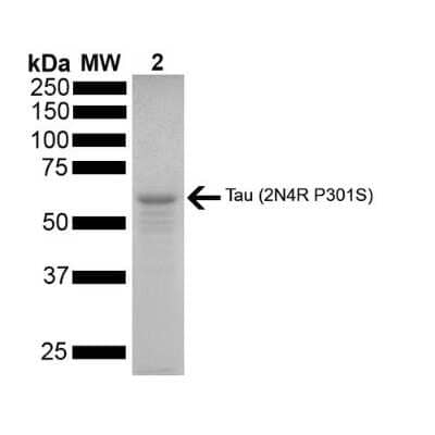 SDS-Page: Recombinant Human Tau 441 Active, Monomer, P301S Mutant Protein [NBP2-76795] - SDS-PAGE of ~67 kDa Human Tau Protein 2N4R P301S Monomer (NBP2-76795). Lane 1: MW ladder. Lane 2: Tau Protein Monomer (NBP2-76795)