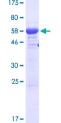 SDS-PAGE Recombinant Human Tesmin GST (N-Term) Protein