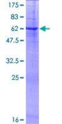 SDS-Page: Recombinant Human Testisin/Prss21 Protein [H00010942-P01] - 12.5% SDS-PAGE Stained with Coomassie Blue.