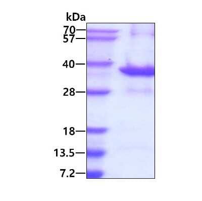 SDS-PAGE Recombinant Human Tollip His Protein