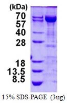 SDS-Page: Recombinant Human Transketolase Protein [NBP1-99073] - 15% SDS-PAGE (3ug)