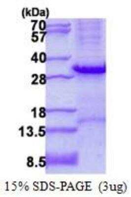 SDS-Page: Recombinant Human Tryptase alpha/TPS1 Protein [NBP2-22894]