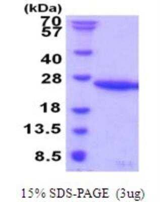 SDS-Page: Recombinant Human UBE2G1 Protein [NBP2-51899]