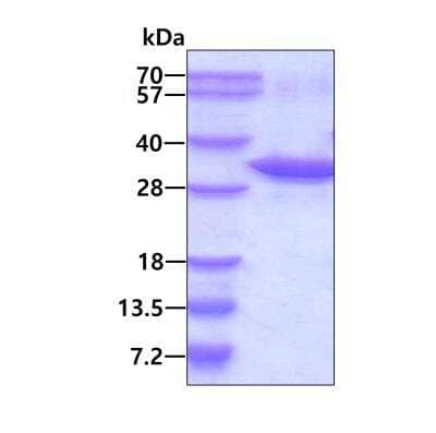 SDS-PAGE Recombinant Human UBE2Z His Protein