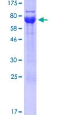 SDS-Page: Recombinant Human UBXN6 Protein [H00080700-P01] - 12.5% SDS-PAGE Stained with Coomassie Blue.