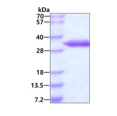 SDS-Page: Recombinant Human UCK2 His Protein [NBP1-50888] - 3ug by SDS-PAGE under reducing condition and visualized by coomassie blue stain.