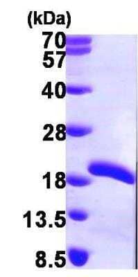 SDS-Page: Recombinant Human UEV2 Protein [NBP1-45295] - 15% SDS-PAGE (3ug)