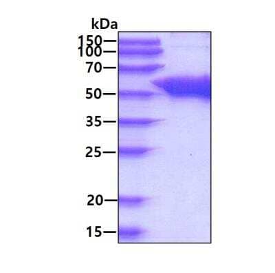 SDS-PAGE Recombinant Human UGP2 His Protein
