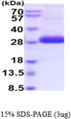 SDS-Page: Recombinant Human ULBP-2 Protein [NBP2-59528] - 15% SDS-PAGE (3ug)