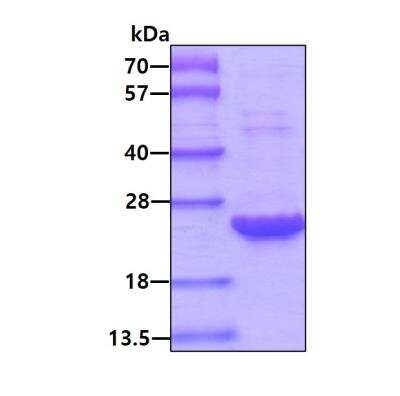 SDS-Page: Recombinant Human UROS His Protein [NBP1-72312] - 3ug by SDS-PAGE under reducing condition and visualized by coomassie blue stain.