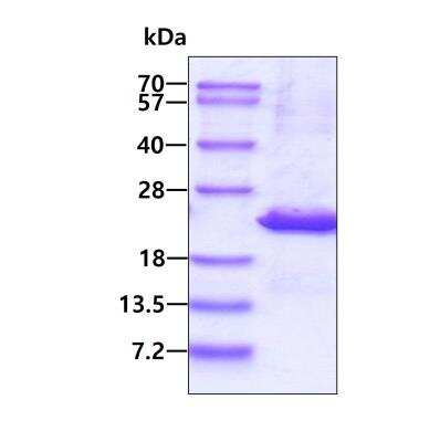 SDS-PAGE Recombinant Human UXT His Protein