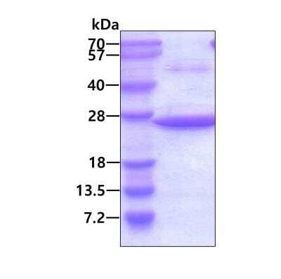 SDS-PAGE Recombinant Human Uroplakin III His Protein