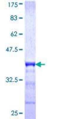 SDS-Page: Recombinant Human Uroplakin Ib Protein [H00007348-Q01] - 12.5% SDS-PAGE Stained with Coomassie Blue.