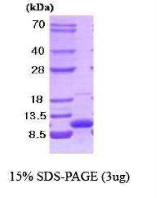 SDS-Page: Recombinant Human VAMP3/Cellubrevin Protein [NBC1-18346]