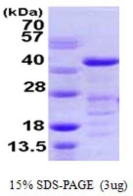 SDS-Page: Recombinant Human VASP Protein [NBP1-51073] - 15 % SDS-PAGE (3ug)