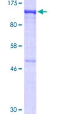 SDS-Page: Recombinant Human VDP p115 Protein [H00008615-P01] - 12.5% SDS-PAGE Stained with Coomassie Blue.