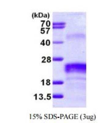 SDS-PAGE Recombinant Human VEGF 165 His Protein